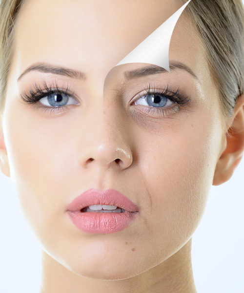 antiAging