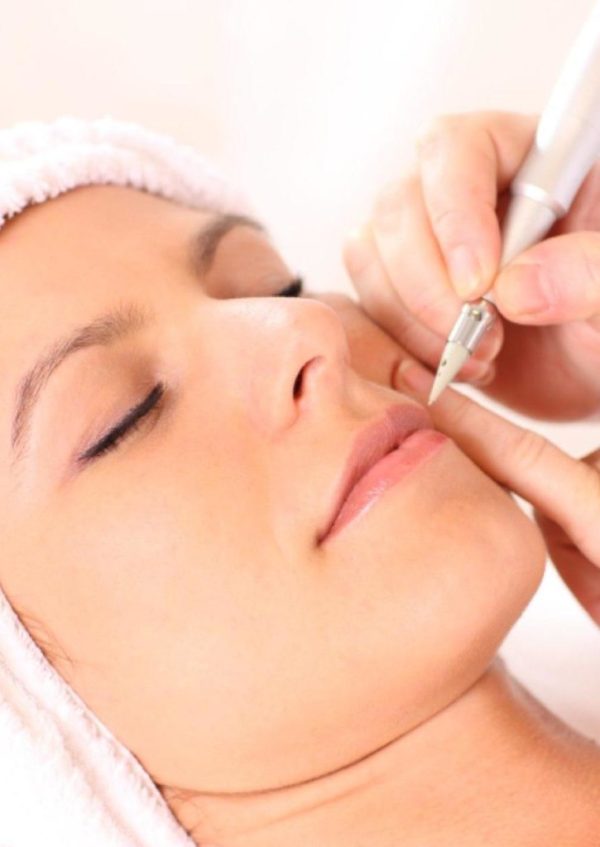 electrolysis